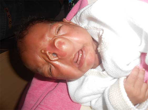 300915_madagaskar_plastchirurgie